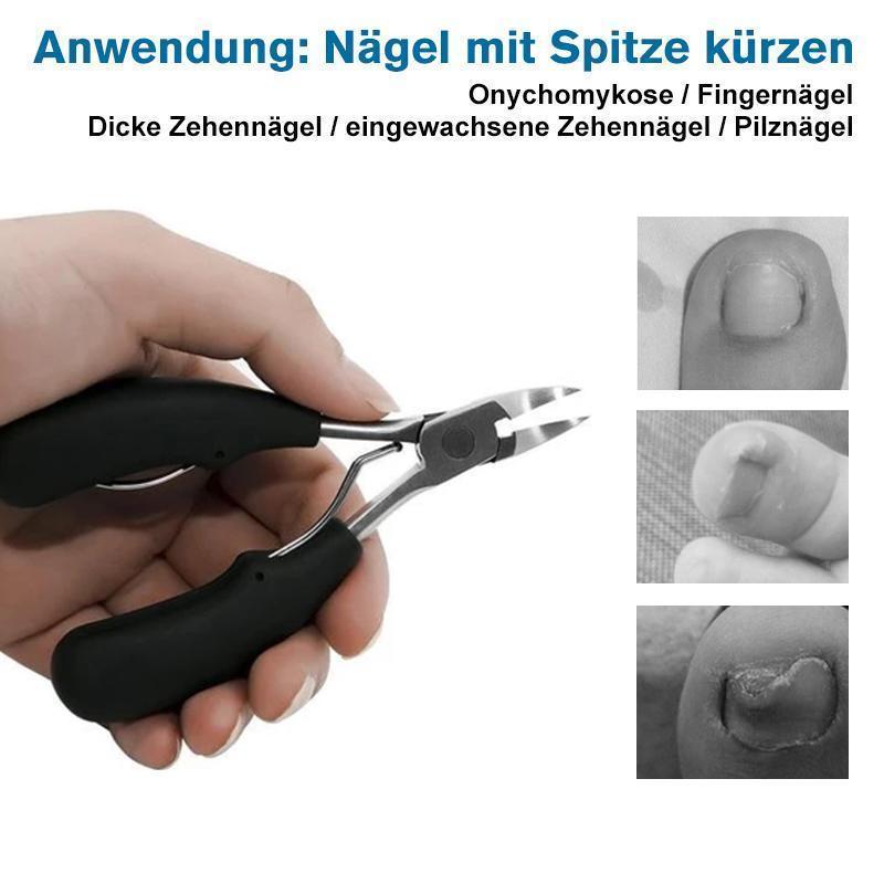 304 Edelstahl Nagelknipser-Set, Vorbeugung von Paronychie, Pilzinfektion